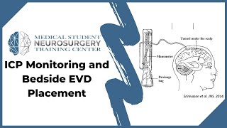 ICP Monitoring and Bedside EVD Placement [upl. by Neetsyrk]