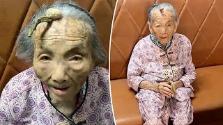 Woman lives to 107 despite 4inch ‘longevity horn’ growing from her forehead [upl. by Quillan384]