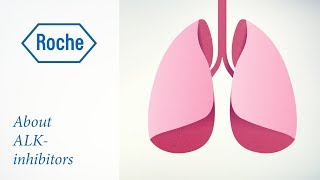 How do ALKinhibitors work in ALKpositive lung cancer [upl. by Errised]