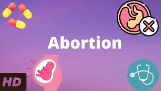 Abortion Everything You Need To Know [upl. by Lulita]