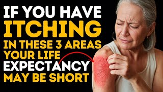 If you have ITCHING in these 3 areas YOUR LIFE EXPECTANCY may be short [upl. by Elyac652]