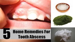 Home Remedies For Abscessed Tooth [upl. by Mosra]