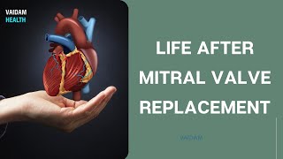 Mitral Valve Replacement Procedure Animation by Cal Shipley MD [upl. by Bohannon]