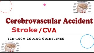 CVAStroke ICD10CM Coding Guidelines  TAMIL [upl. by Ahasuerus]