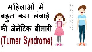 महिलाओं में बहुत कम लंबाई की जेनेटिक बीमारी  Turner syndrome in hindi [upl. by Culberson]