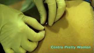 Piercing Ombligo Navel Piercing [upl. by Thibaut660]