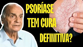 EXISTE CURA DEFINITIVA PARA PSORÍASE  SAIBA [upl. by Min169]