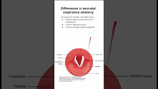 Differences in neonatal respiratory anatomy [upl. by Levi]