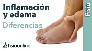 Inflamación y edema  Diferencias y características [upl. by Chong]