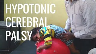 Hypotonic Cerebral Palsy Home Tips amp Physiotherapy [upl. by Harac]