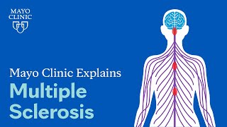 Mayo Clinic Explains Multiple Sclerosis [upl. by Padgett]