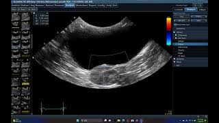 5565 CRYPTORCHIDISM  ECHOPAC ANALYSIS HIDDEN TESTIS ABDOMINAL ULTRASOUND DOG [upl. by Lettig889]