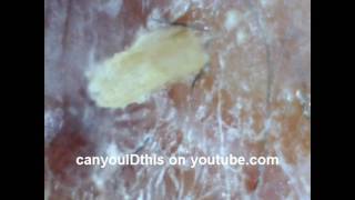 ID THIS SKIN INFECTION PARASITE NEMATODE FUNGUS MRSA BACTERIAL [upl. by Jeraldine]