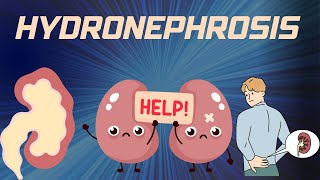 HYDRONEPHROSIS  Pathophysiology Causes signs and symptoms background diagnosis and treatment [upl. by Nonac552]