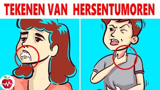 10 Waarschuwingstekens Dat Je Een Hersentumor Hebt [upl. by Sabelle331]