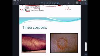 شرح Mycology Dermatophytes 1 [upl. by Sulecram]