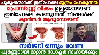 പുരുഷന്മാർക്ക് ഇത് പോലെ മൂത്രം പോകുന്നത് പ്രോസ്റ്റേറ്റ് വീക്കം ഉള്ളപ്പോഴാണ് [upl. by Acinomahs]