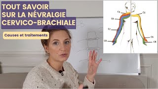 NÉVRALGIE CERVICOBRACHIALE  cause et symptômes pour mieux agir ensuite [upl. by Sprage]