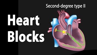 Heart Blocks Anatomy and ECG Reading Animation [upl. by Notnroht]