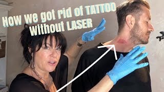 REMOVE TATTOOS NO LASER  BEFORE AND AFTER  Salt Saline Lime amp Gycolic Tutorial [upl. by Noitsirhc]