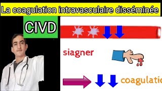 la coagulation intravasculaire disiminée civd [upl. by Zetroc]