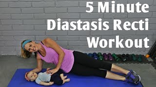 5 Minute Diastasis Recti WorkoutPostpartum core workout for Ab Separation [upl. by Prosperus116]