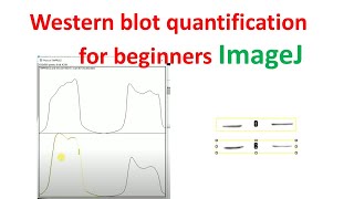 Quantification of western blot using imageJ for beginners  western blot quantification  imagej [upl. by Travers449]