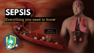 Sepsis Everything You Need to Know [upl. by Ardath]