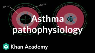 Asthma pathophysiology  Respiratory system diseases  NCLEXRN  Khan Academy [upl. by Clarita]