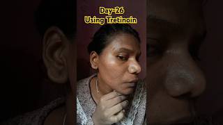 Day26 Using Tretinoin 0025 cream viralvideo tretinoin shorts skincare youtubeshorts [upl. by Rusty]