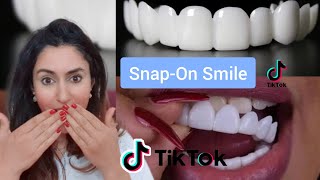 Orthodontist Reacts To SnapOn Veneer TikToks [upl. by Wei]