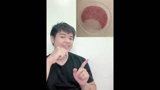 If you have back pain Try Cupping therapy once massage xuhuong cupping Giachoi asmr viral [upl. by Standish]