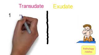 Edema Pathology Part  3 Hemodynamics Transudate versus Exudate Fmge Neet PG usmle Pathology Notes [upl. by Delfine]