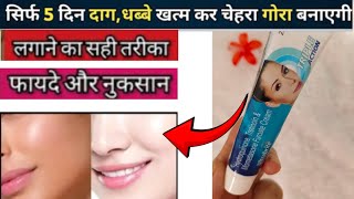 Ultrabrite Skin Cream  Ultrabrite Cream Uses  Ultrabrite Cream Benefits And Side Effects [upl. by Ial637]