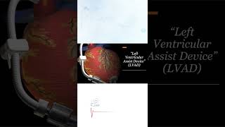 Left Ventricular Assist Device LVAD [upl. by Lepine122]