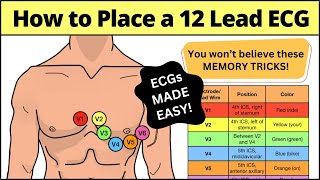 12 Lead ECG Placement MADE EASY EMT Nursing Paramedic ecg nursing [upl. by Joed]