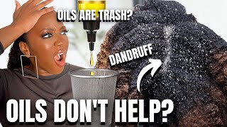 Oils DONT Help Dry Scalp amp Dandruff  Black Hair [upl. by Yllaw538]