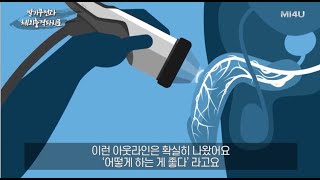 발기부전과 체외충격파 발기부전에서 1차 치료법의 변화발기부전 이야기27 비뇨기과 전문의 박성훈 [upl. by Kenney]