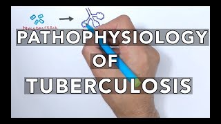 Pathophysiology of Tuberculosis [upl. by Sessylu]