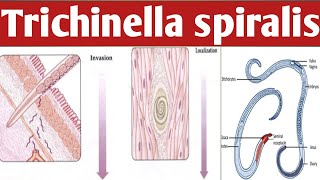 How Trichinella Spiralis Can Transform Your Body Ahmaric Tutorial [upl. by Shannah]