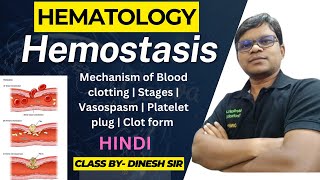 Hemostasis  Mechanism of Blood clotting  Stages  Vasospasm  Platelet plug  Blood clot  Hindi [upl. by Katherin778]