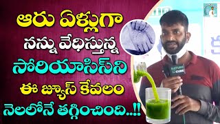 ఆరు ఏళ్లుగా నన్ను వేధిస్తున్న సోరియాసిస్ ని ఈ జ్యూస్ కేవలం నెలలోనే  DR Ramachandra Channel [upl. by Thacker495]