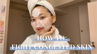 How To Fight Congested Skin amp Breakouts  Deep Cleansing amp Skincare Routine  glowwithava [upl. by Ahseret]