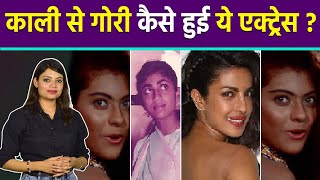 Top Bollywood Dark Skin Actresses जो अब Skin Whitening से हो गई Fair  Boldsky [upl. by Ellinet]