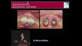 Rational and Predictable Periodontal Plastic Surgery by Michael K McGuire [upl. by Mcleod]