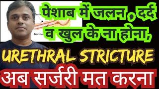 urethral stricture treatment with homeopathic medicines [upl. by Blackstock]