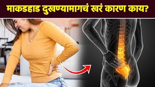 माकडहाड दुखत असेल तर काय करावं   Tailbone Pain Exercises  Lokmat Sakhi  RI3 [upl. by Evelin]