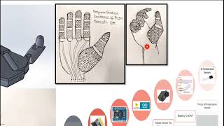 Myoelectric Prosthetic Arm [upl. by Lirret]