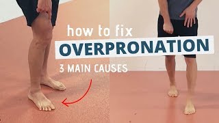 Pronated Feet and How to Fix 3 Different Causes of OVERPRONATION [upl. by Eednac]