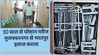 10 साल से परेसान मरीज मुजफ्फरनगर से भरतपुर इलाज कराया tibialplateaufracture ilizarovsurgery [upl. by Heida]